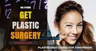 Hyorin's Transformation: Plastic Surgery Rumors and the Truth Behind Them