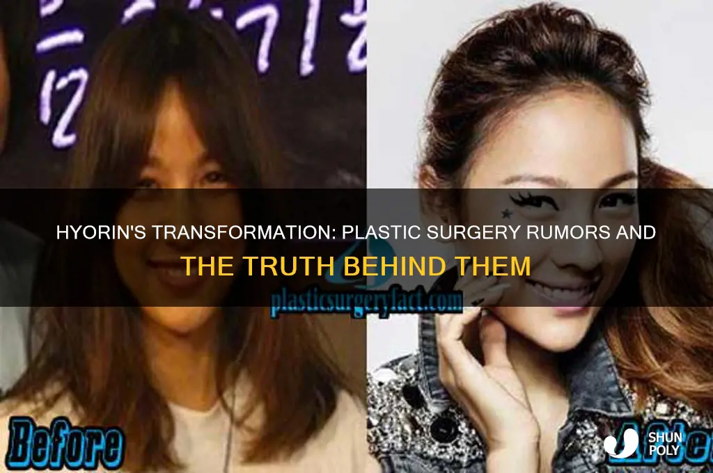 did hyorin get plastic surgery