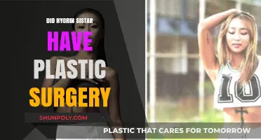 Hyolyn SISTAR Plastic Surgery: Fact-Checking the Transformation Rumors