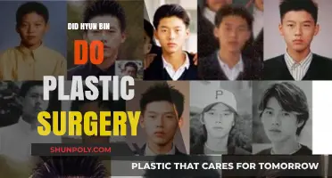 Hyun Bin's Transformation: Plastic Surgery Rumors Explored and Debunked