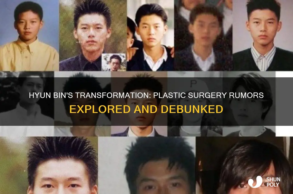 did hyun bin do plastic surgery