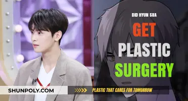 Hyun Sua's Transformation: Plastic Surgery Rumors Explored and Analyzed