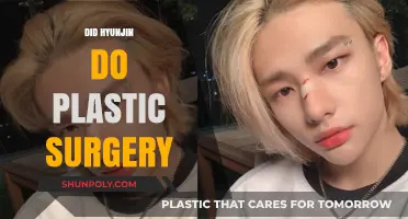 Hyunjin's Transformation: Unveiling the Truth About Plastic Surgery Rumors