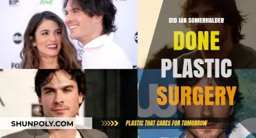 Ian Somerhalder's Transformation: Plastic Surgery Rumors Explored
