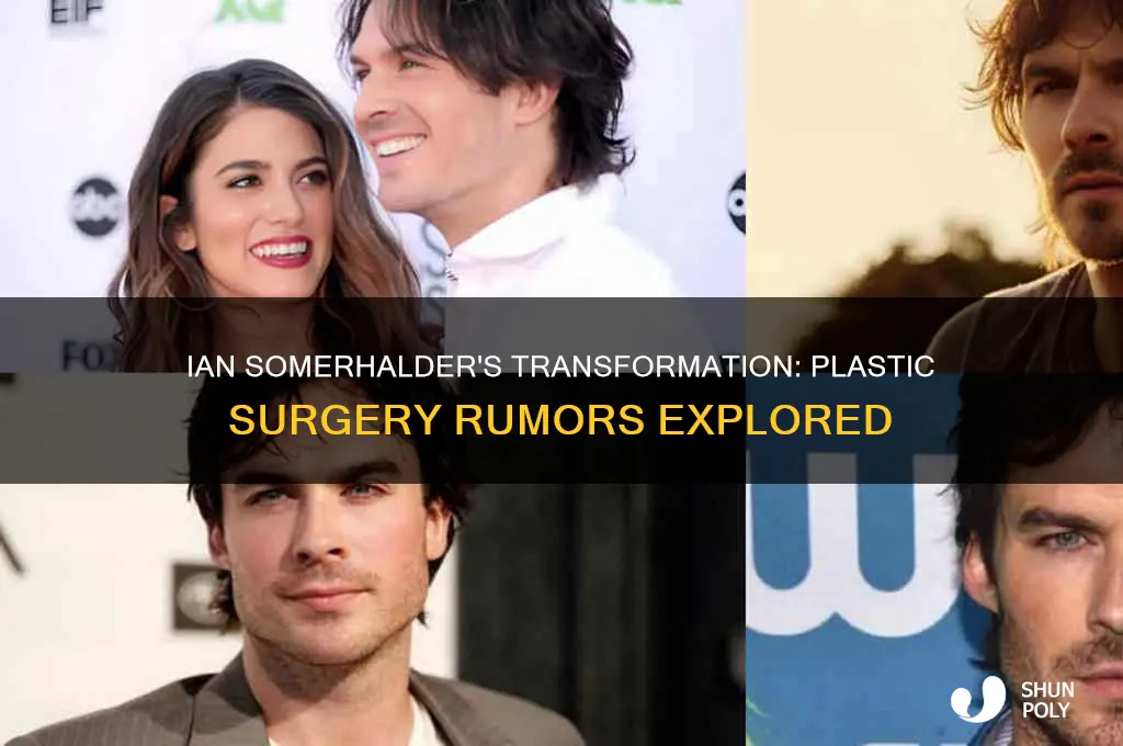 did ian somerhalder done plastic surgery