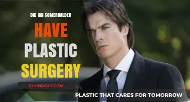 Ian Somerhalder's Transformation: Plastic Surgery Rumors Explored