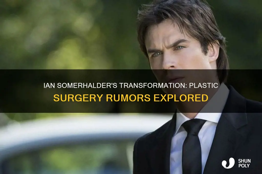 did ian somerhalder have plastic surgery