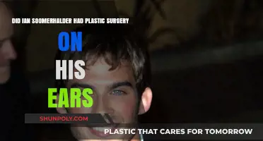 Ian Somerhalder's Ear Transformation: Plastic Surgery Speculation Explored