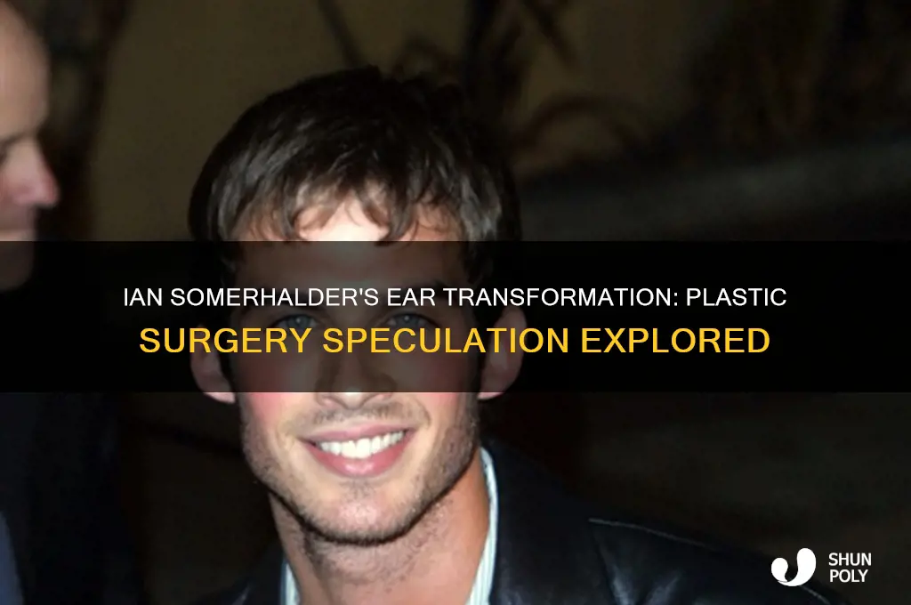did ian soomerhalder had plastic surgery on his ears