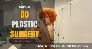 Ice Spice Plastic Surgery: Fact-Checking the Rumors and Speculations