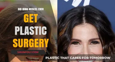 Idina Menzel's Transformation: Plastic Surgery Rumors Explored