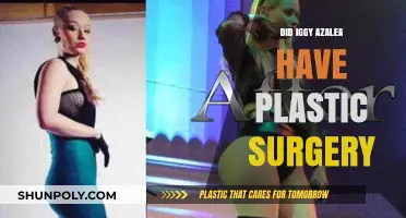 Iggy Azalea's Transformation: Uncovering the Truth About Plastic Surgery