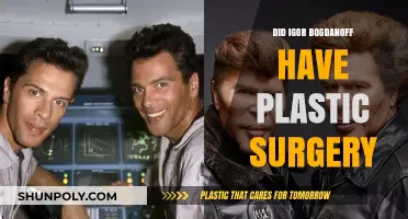Did Igor Bogdanoff Undergo Plastic Surgery? Unraveling the Truth