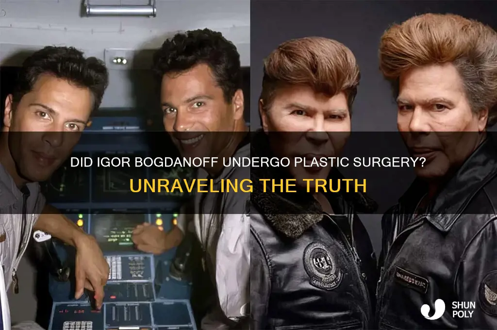 did igor bogdanoff have plastic surgery