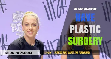 Iliza Shlesinger Plastic Surgery: Fact-Checking the Rumors and Speculations