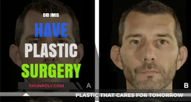 Did Imis Undergo Plastic Surgery? Uncovering the Truth Behind the Rumors