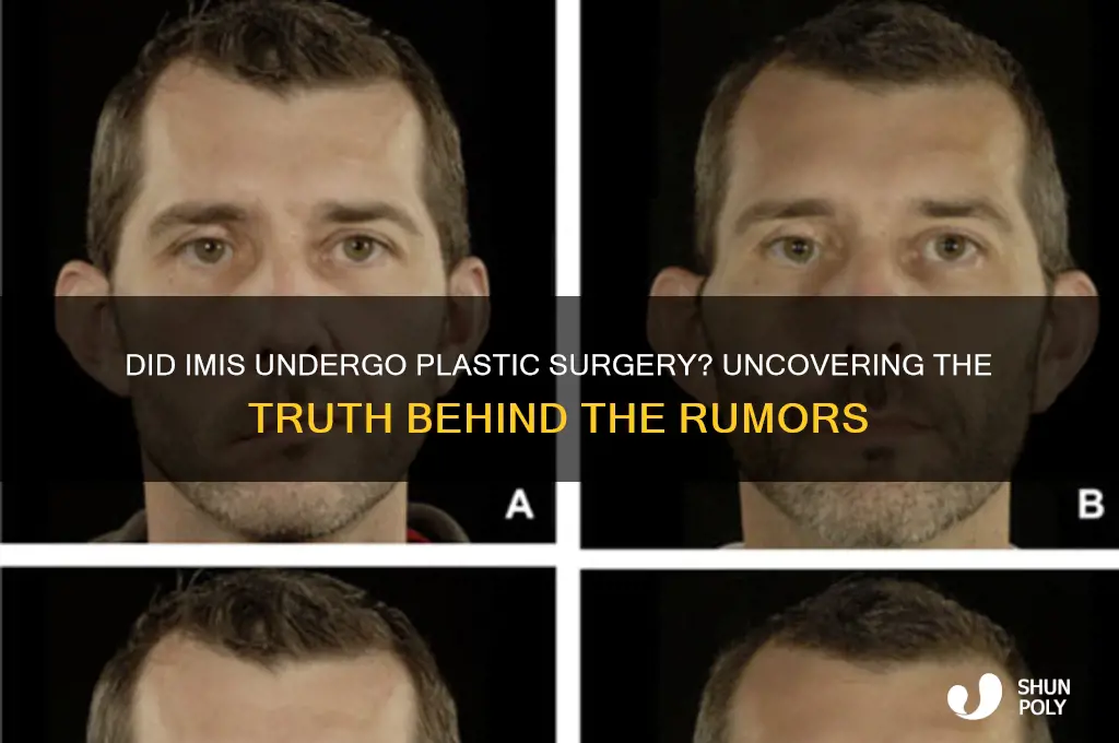 did imis have plastic surgery