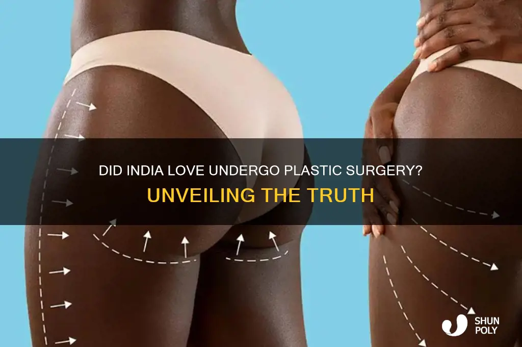 did india love get plastic surgery