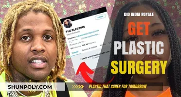 India Royale Plastic Surgery: Fact-Checking the Rumors and Speculations