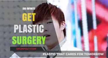 Did Infinite Undergo Plastic Surgery? Unveiling the Truth Behind the Rumors