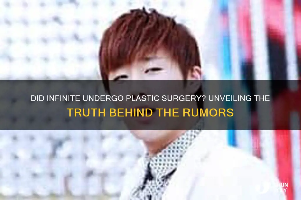 did infinite get plastic surgery