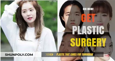 Irene's Transformation: Unveiling the Truth About Plastic Surgery Rumors