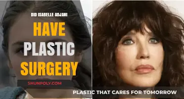 Isabelle Adjani's Transformation: Plastic Surgery Rumors Explored