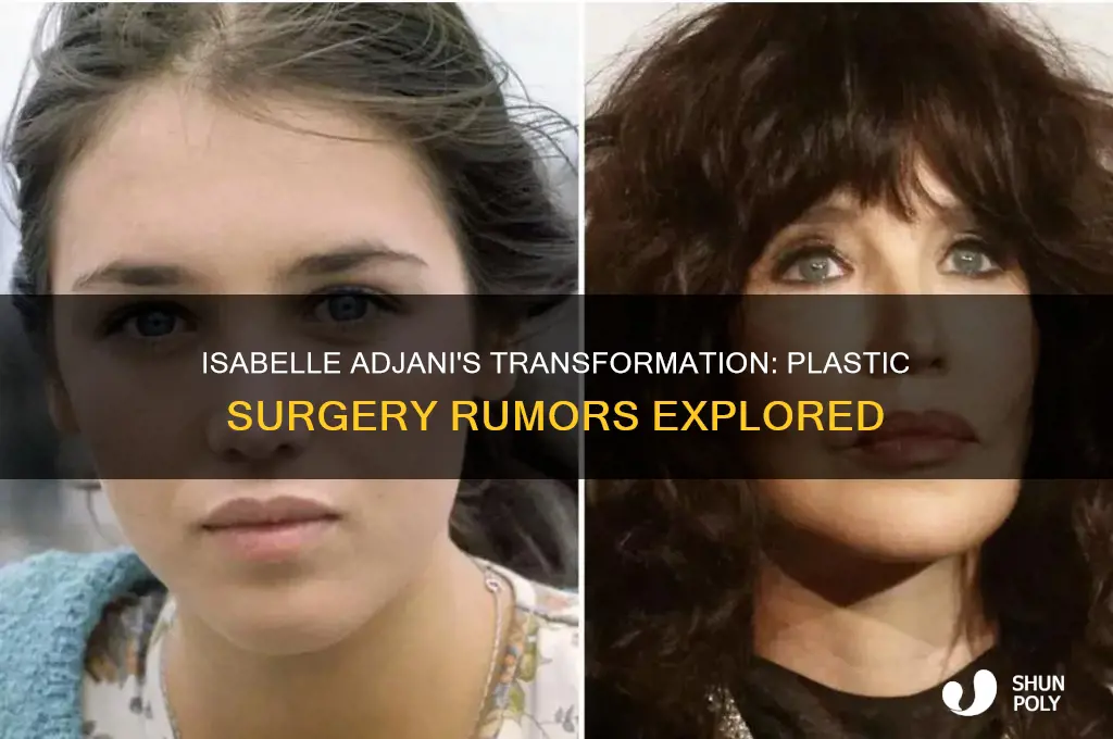 did isabelle adjani have plastic surgery