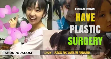 Did Itano Tomomi Undergo Plastic Surgery? Unveiling the Truth