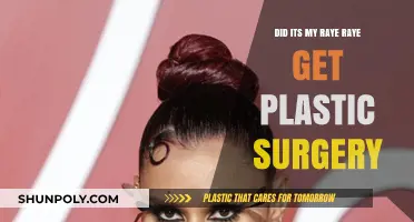 Did Its My Raye Raye Undergo Plastic Surgery? The Truth Revealed