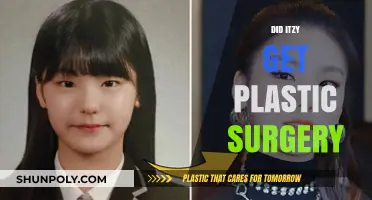 ITZY's Transformation: Plastic Surgery Rumors and Realities Explored