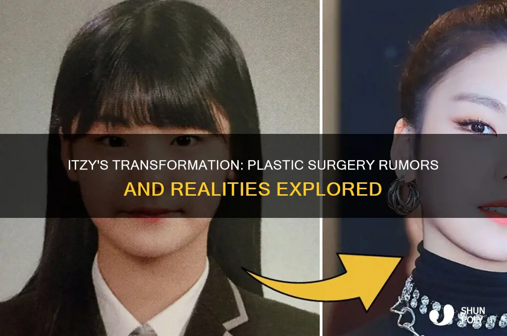 did itzy get plastic surgery