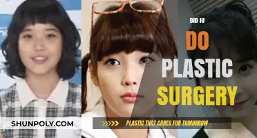 IU's Transformation: Unveiling the Truth About Plastic Surgery Rumors