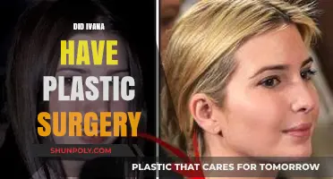 Did Ivana Trump Undergo Plastic Surgery? Unveiling the Truth