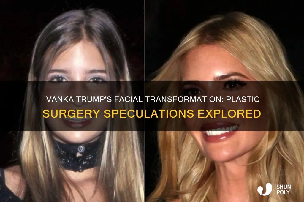 did ivanka have any facial plastic surgery