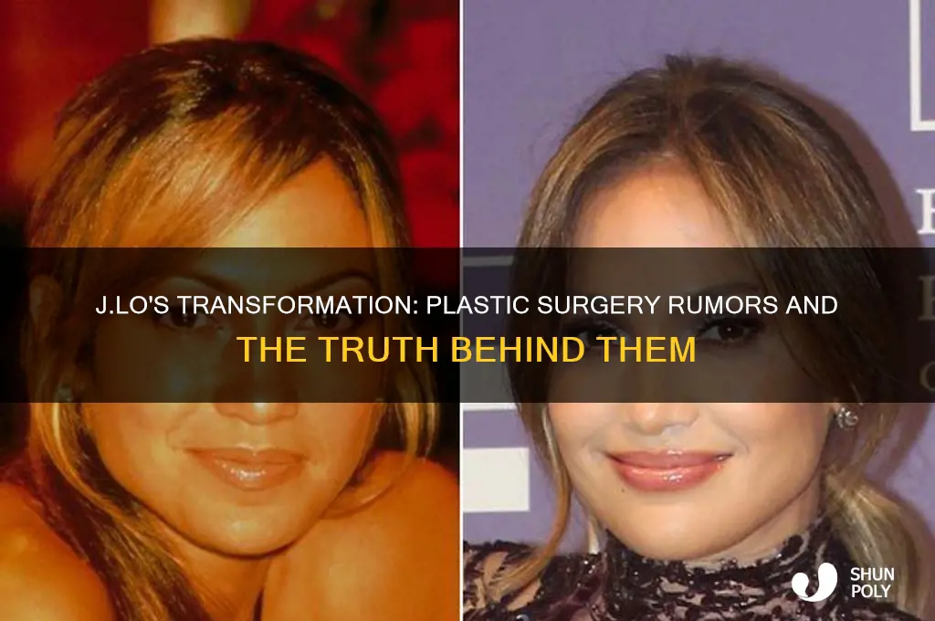did j lo get plastic surgery