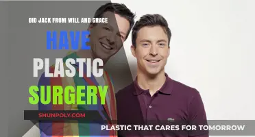 Did Jack from Will & Grace Undergo Plastic Surgery? The Truth
