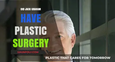 Did Jack Graham Undergo Plastic Surgery? Unveiling the Truth