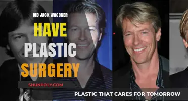 Did Jack Wagoner Undergo Plastic Surgery? Unveiling the Truth