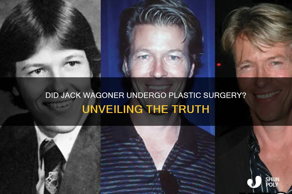 did jack wagoner have plastic surgery