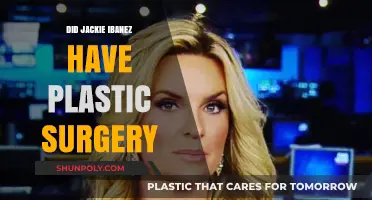 Jackie Ibanez Plastic Surgery: Fact-Checking the Rumors and Speculations
