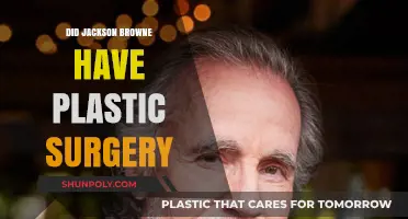 Jackson Browne's Transformation: Plastic Surgery Speculations and Facts Revealed