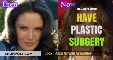 Jaclyn Smith's Ageless Beauty: Plastic Surgery Speculations Explored