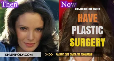 Jacqueline Smith's Transformation: Plastic Surgery Rumors Explored and Debunked