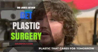 James Arthur's Transformation: Plastic Surgery Rumors Explored and Debunked