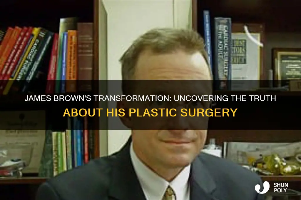 did james brown have plastic surgery