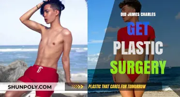 James Charles Plastic Surgery: Fact-Checking the Transformation Rumors