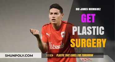James Rodriguez Plastic Surgery: Fact or Fiction? Unveiling the Truth