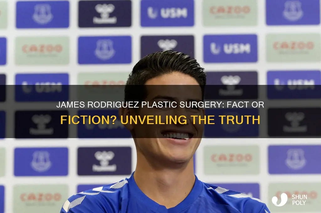 did james rodriguez get plastic surgery