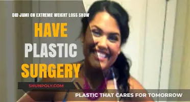 Did Jami from Extreme Weight Loss Undergo Plastic Surgery?